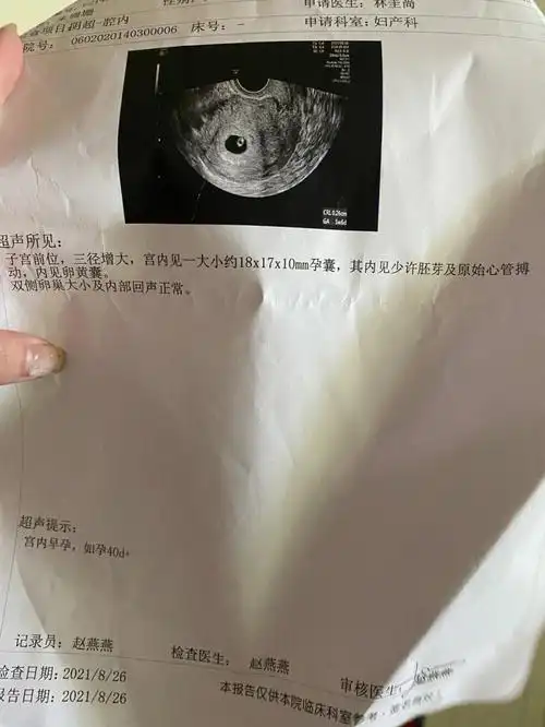 6周773可见胎心胎芽