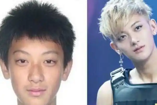 [整容]黄子韬整容之前这么丑 整容前后照片大曝光