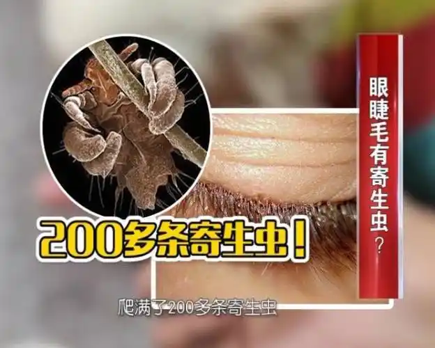 贴片指甲有安全隐患?哪种方法去黑头最靠谱?