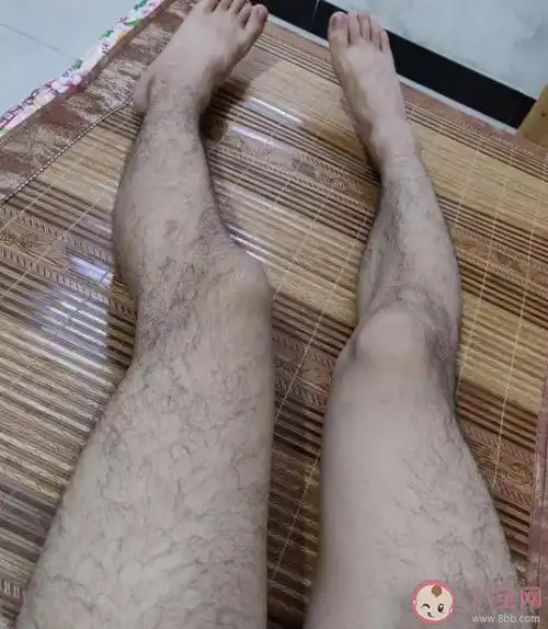 女生腿毛会越刮越粗越硬吗 腿毛多该怎么办-第3张图片-创女网