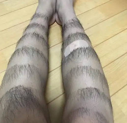 你有腿毛吗慎入