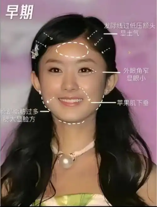 总感觉哪里变了,又感觉哪里都没变|圆脸|脸型|赵丽颖|苹果肌|发际线