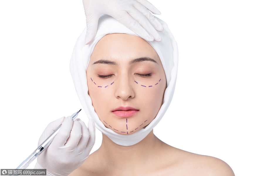 女性面部整形术前画线