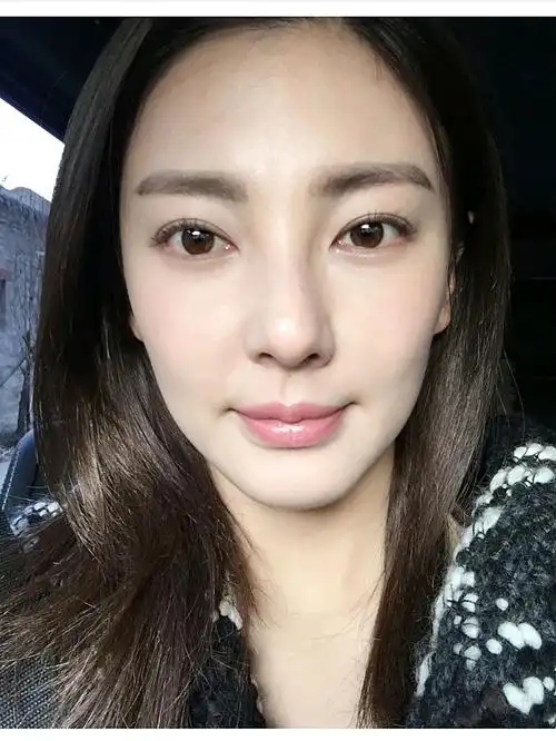 张雨绮双眼皮的蜕变史757575