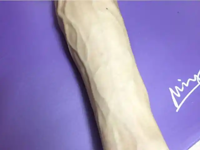 暴起的情况,生活中我们所说的青筋是人体皮下组织经常出现的静脉血管