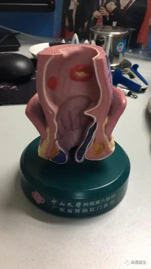 肛门指检不得不说的那些细节