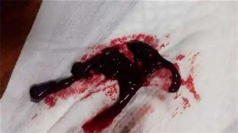 排卵后四天有一点点出血怎么回事 我月经已经完了3到4天,现在白带很黄