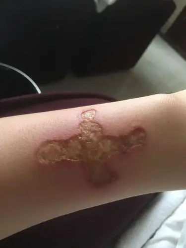 某种原因导致心理特别痛苦,喝多了之后烫了这些烟疤