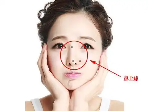 能干大事业的女人痣,女性的痣有哪十处是富贵痣?