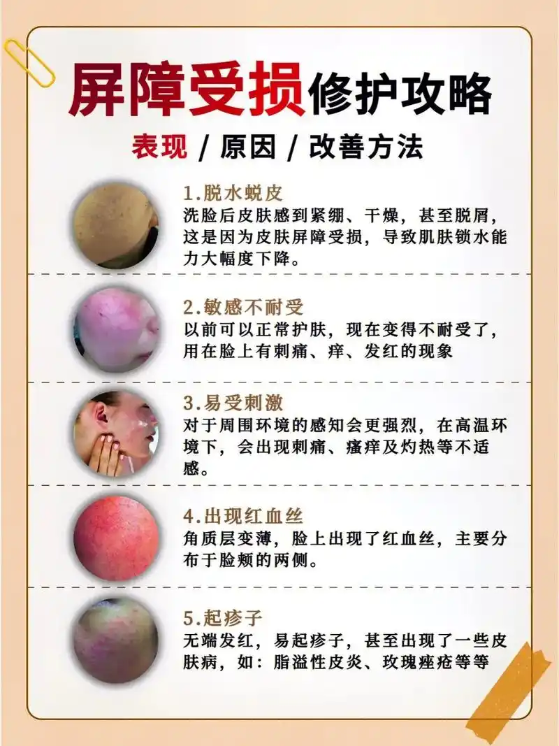 皮肤屏障受损的5个表现 - 抖音