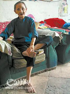 赤脚走路穿街过巷70年 阿婆脚底板竟光滑无老茧(图)