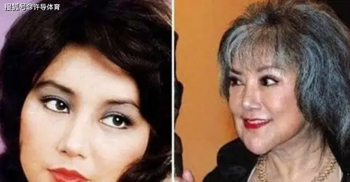 6位"整容"失败的女星:邵音音能吓到路人,最后一位是真的可惜
