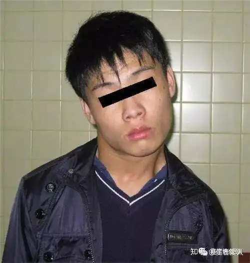 痉挛性斜颈(歪脖子)到底是怎么回事?下面为大家详细讲解