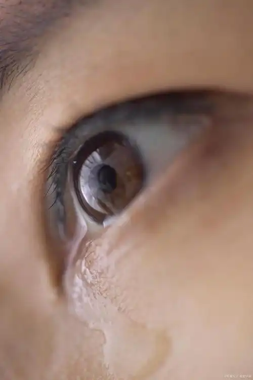 为什么天冷的时候眼睛总爱流眼泪?