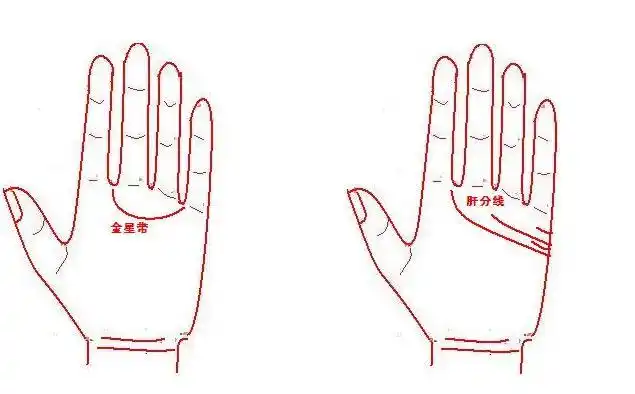 掌纹预示出肝癌早期征兆,"肝"不好看手就知道了!