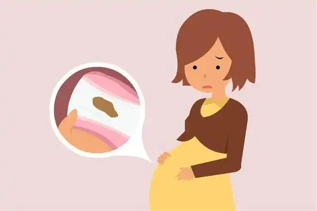 孕期内裤分泌物有异样可能是胎儿的求助信息要懂得辨别
