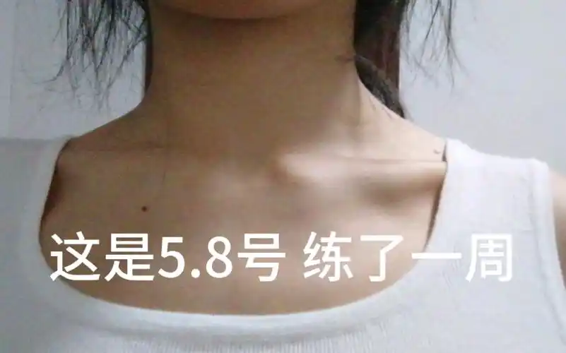 求助斜方肌鼓包有跟duke天鹅颈运动就是那个斜方肌拉伸的姐妹吗现在出