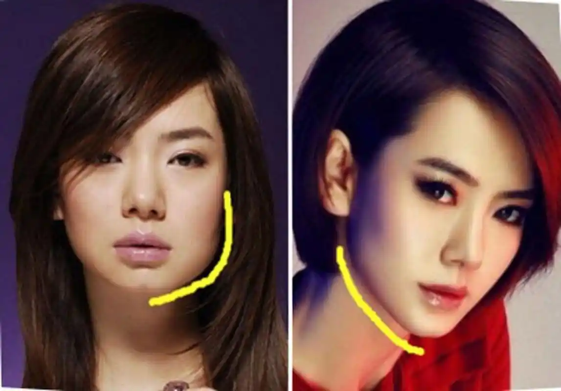 不知大家有没有发现,以前去整容的大都是明星,歌星,网红,他们的长相