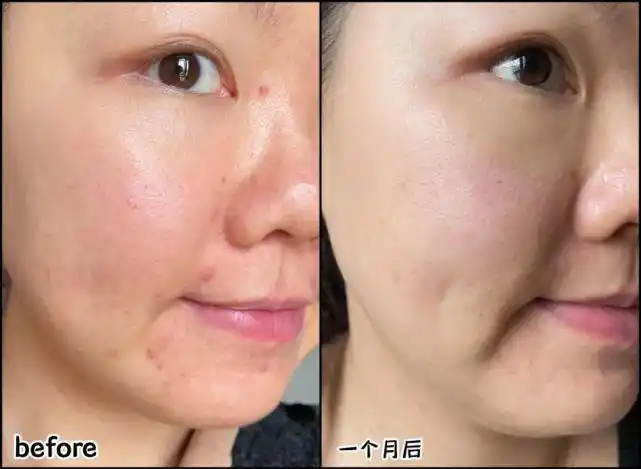 这件事做不好太容易踩坑,来看看她们的小经验吧