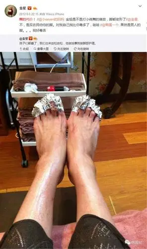 长腿女神的双脚被指太畸形 大拇指外翻简直触目惊心