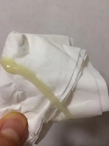 请问谁知道排卵期白带是什么样的,我8月3日月经结束,最近几天白带是