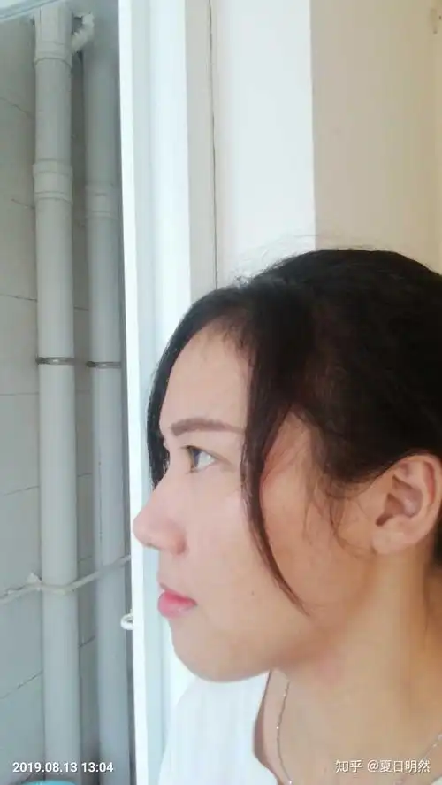 高鼻梁的女生是什么体验?