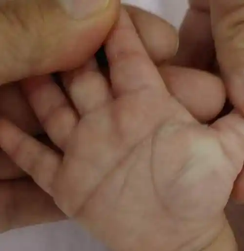 掌纹真的掌握人的命运吗