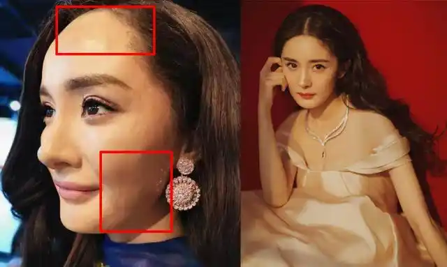 皮肤凹凸不平发际线后移,弱灯光下很吓人