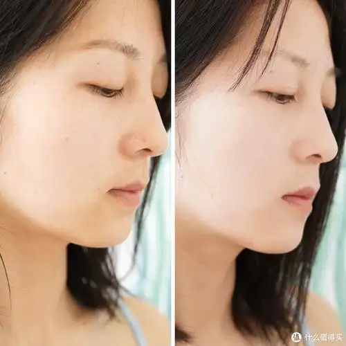 皮肤长期拔干,可能是自来水出了问题——a.o.史密斯美容软水机