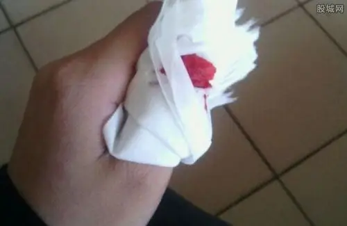 9岁娃挥斧自断手指 自残真相曝光只为证清白