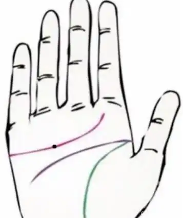 感情线上出现黑痣会怎么样?