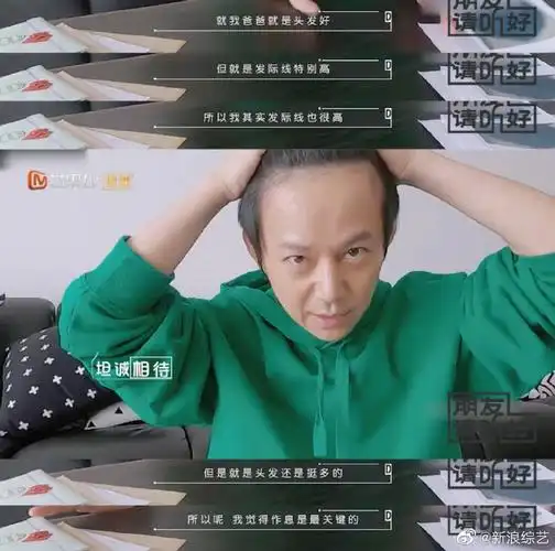 组图:刘海能有多减龄?何炅露发际线亲身示范