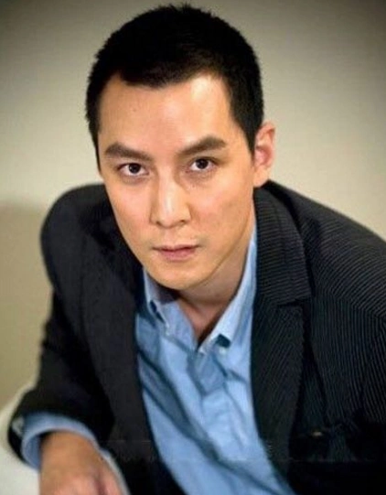 男生发际线高适合什么发型高发际线m字额头怎么挑发型