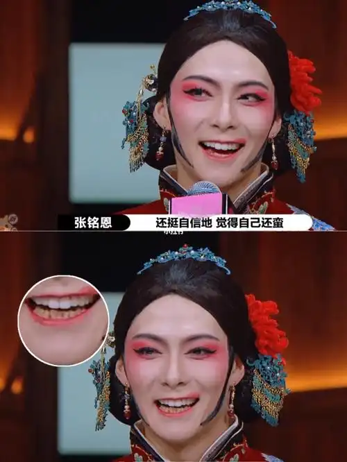张铭恩,你说话时牙齿暴露了做的全瓷贴面_演员请就位影评_帅哥_拍照