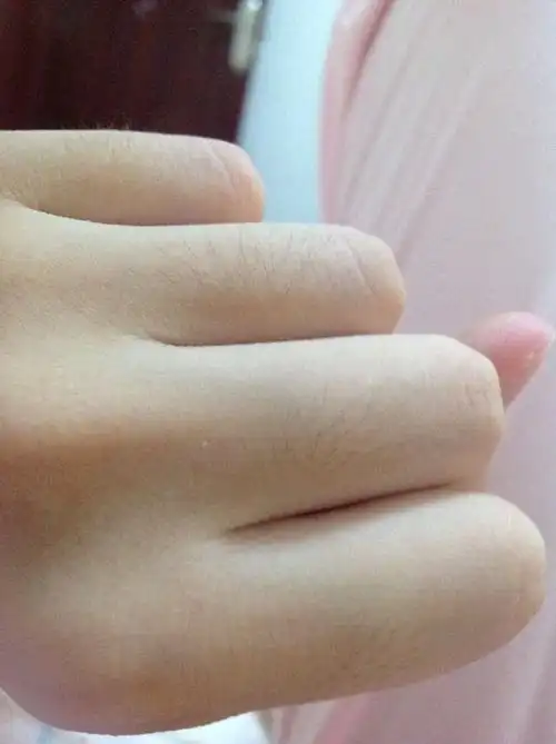 手上的毛太长太多怎么办
