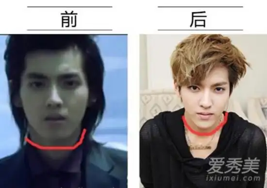 刘恺威明星整容前后     除了煞白的肤色受质疑,吴亦凡的脸型也很可疑