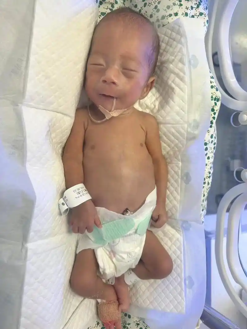 早产儿2.6.宝宝生命力的顽强是我们不可想象的!七天七夜,只 - 抖音