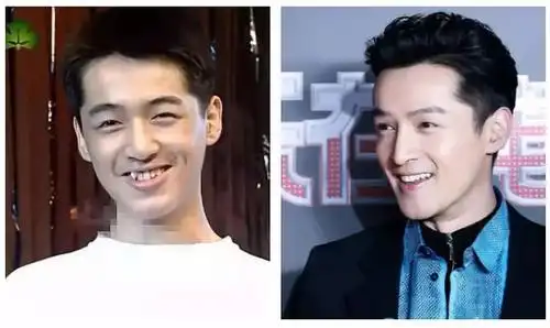 如果你牙齿是这样,急需矫正! 1,间隙