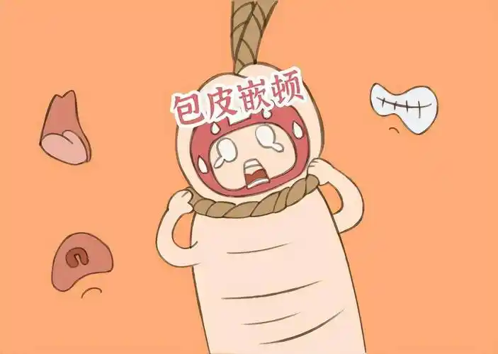 致龟头嵌頳于包皮口,长时间嵌頳的话会导致龟头水肿甚至龟头缺血坏死