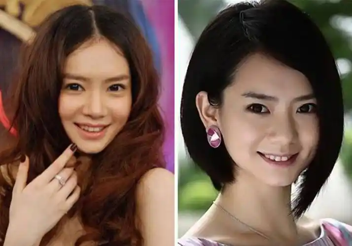 戚薇做双眼皮前后对比照戚薇整容部位:眼睛戚薇曾在某综艺节目中,她很