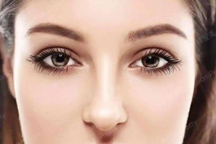 亚洲人适合做深邃的欧式双眼皮吗