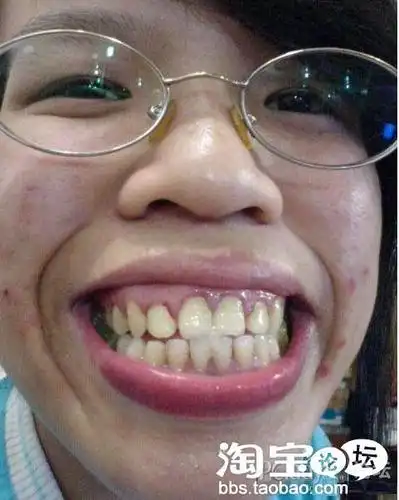 【强帖】网络十大丑女,此帖有强烈的催吐功能 胆小者勿进