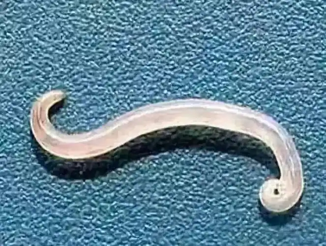 首先,我们先了解一下什么是"蛲虫".