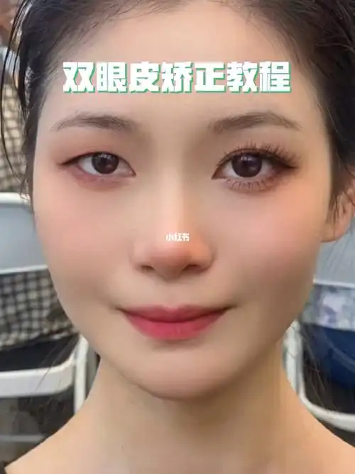 如何把单眼皮贴成双眼皮教程