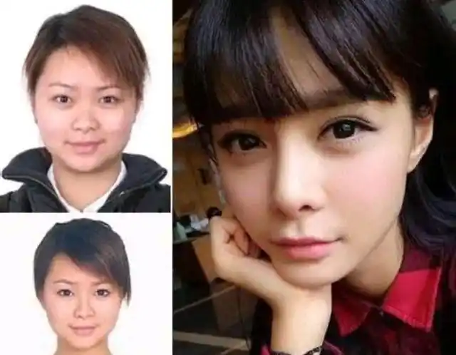 15位当红明星整容前后谁堪比换了个头