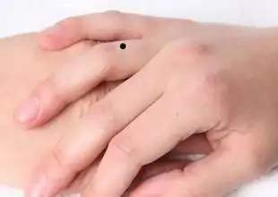 女人手痣相图解