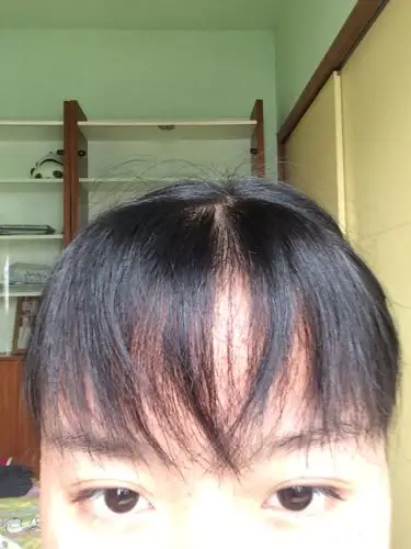 是这样的 前个星期去把刘海给打薄了 可是理发师给我打的又薄又扁 很