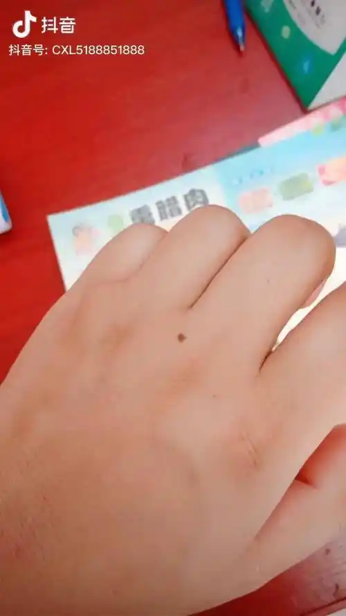 全抖音寻找一个左手有痣的妇女准备彩礼103w天涯海角我来找你