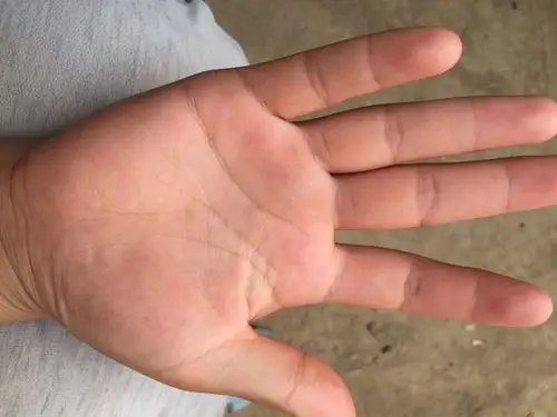 看我的手相,金星丘有三角形是什么预兆?