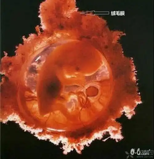 面向基蜕膜部分的绒毛发育旺盛,分枝繁茂,称为叶状绒毛膜,形成为胎盘